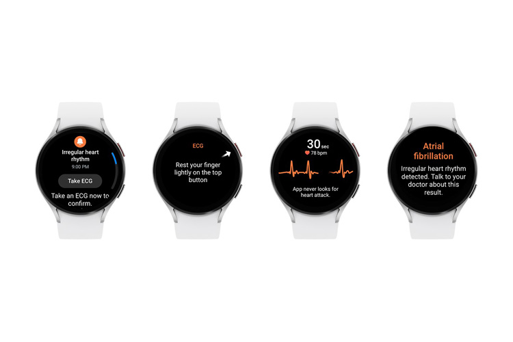 Irregular Heart Rhythm Notification on the Galaxy Watch